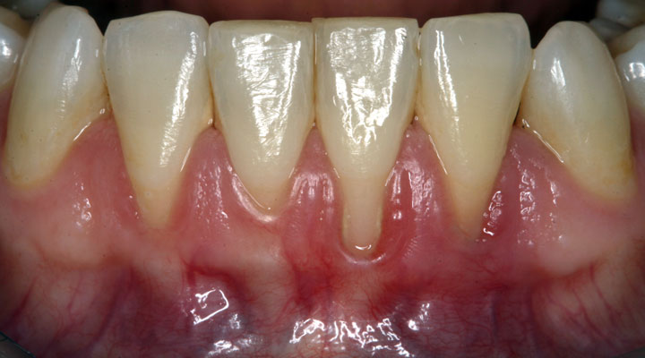 parodontologia torino